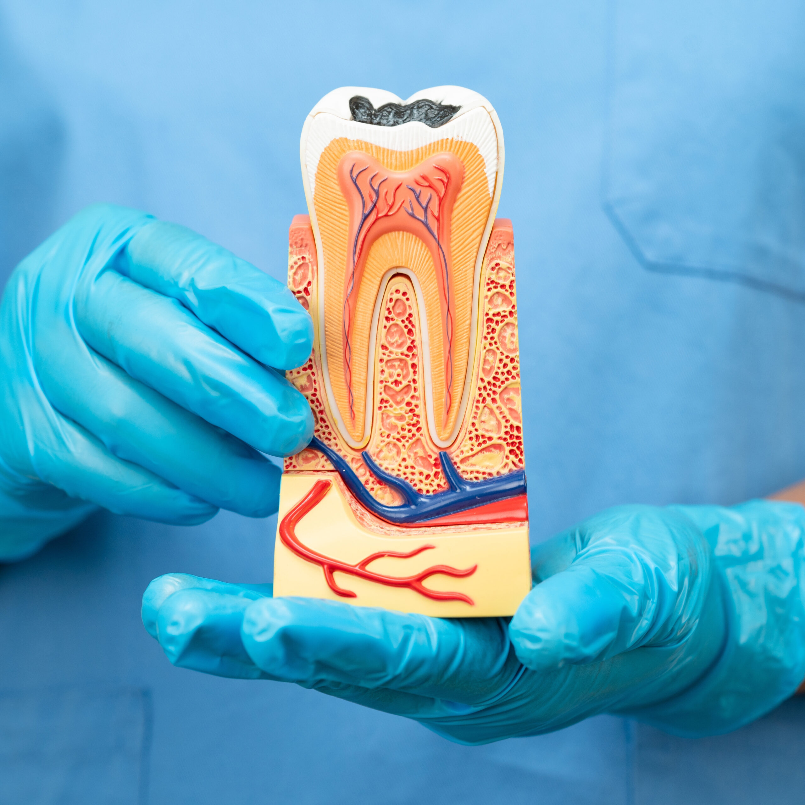 Gloved hands holding a cross-sectional model of a tooth showing enamel, dentin, pulp chamber, root canals, blood vessels, and nerves.
