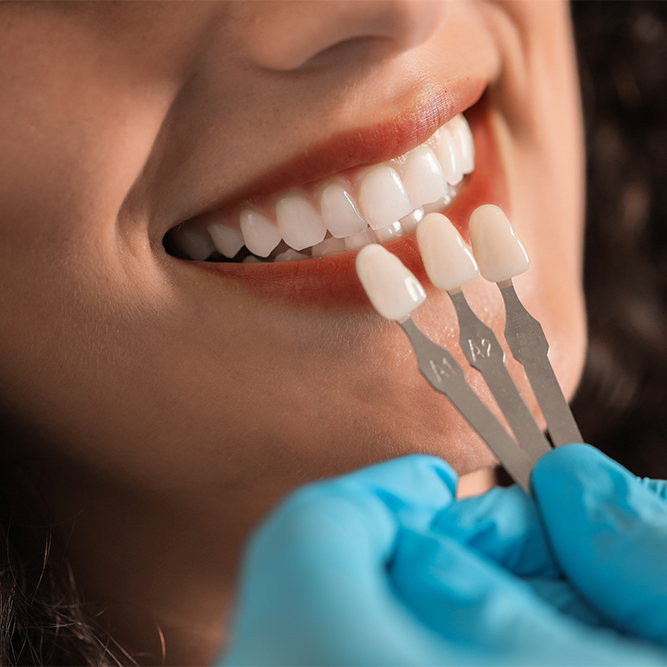 Dentist matching porcelain veneer shades to patient's teeth during cosmetic dental consultation at Natural Clinic